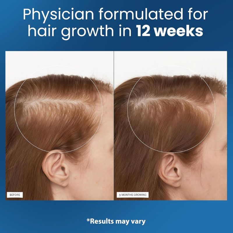 NewMama - Regrowth Serum with built-in Applicator